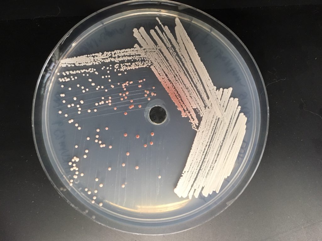 Yeasts that make a red pigment on a plate